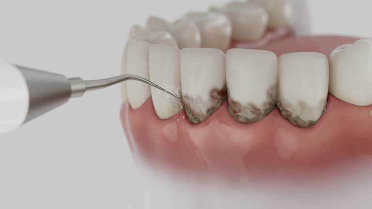 Trusted Root Canal Treatment service in Hope Mills, NC - Dentist Open Now